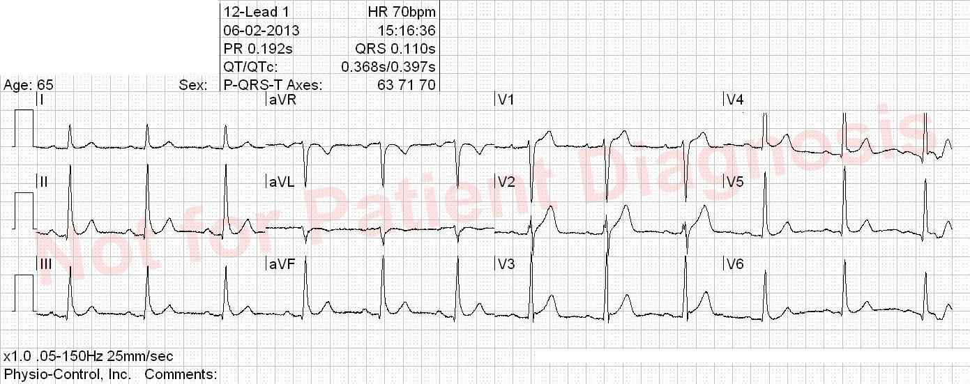 free ekg practice