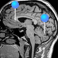 imaios e anatomy