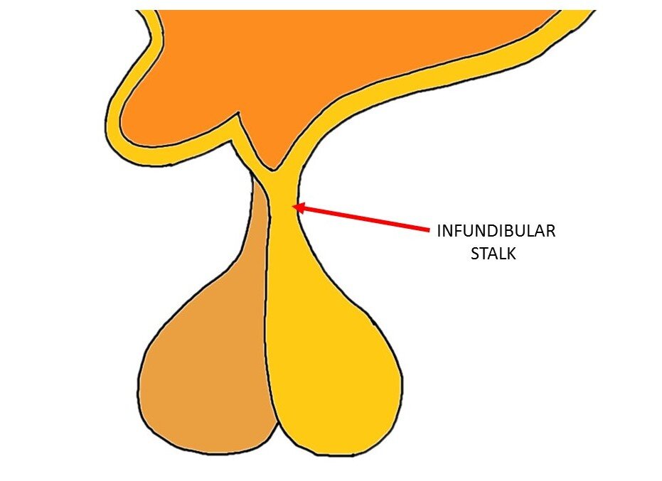 what is infundibulum in the brain