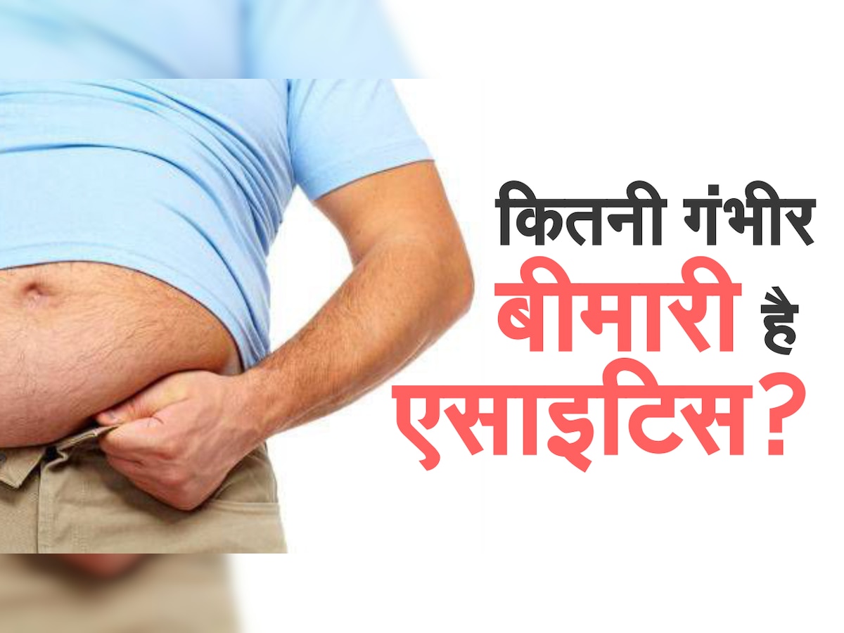 mild to moderate ascites in hindi