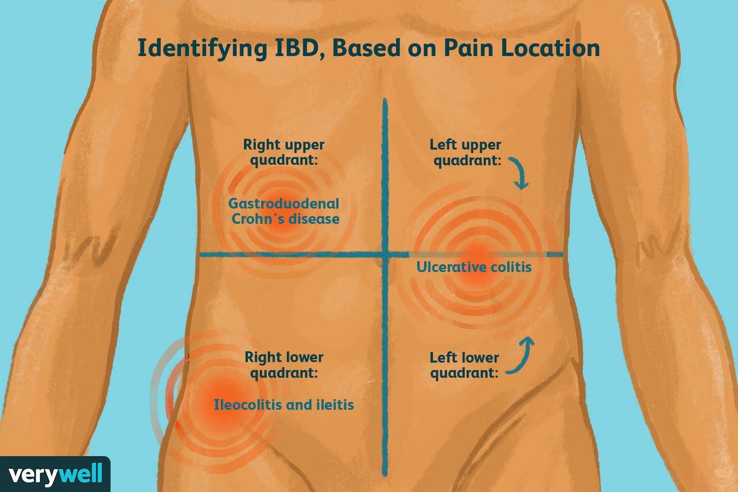 pain beneath ribs right side