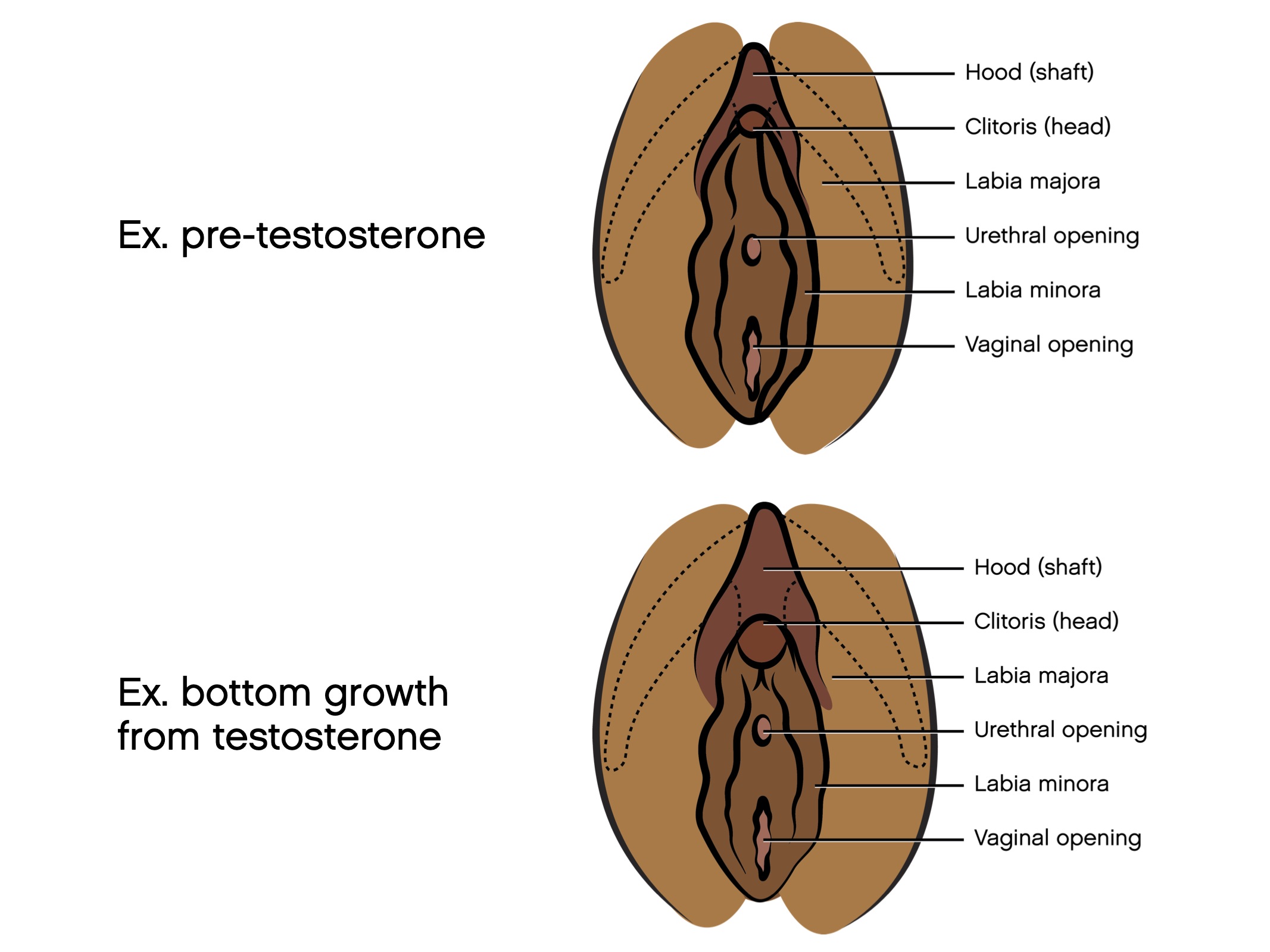 ftm clit