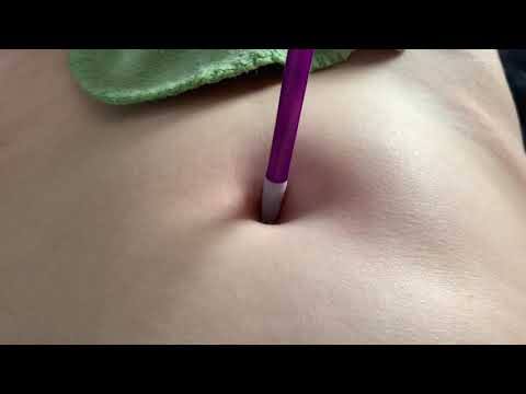 navel torture