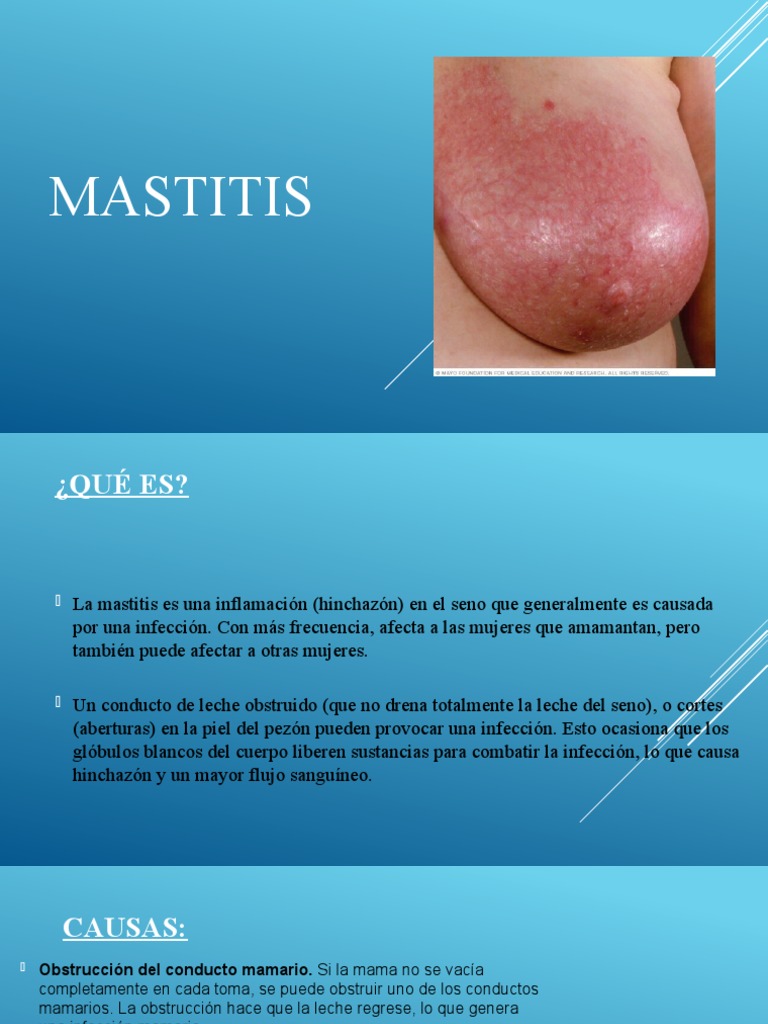 mastitis gpc