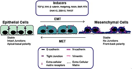 emt epithelial mesenchymal transition