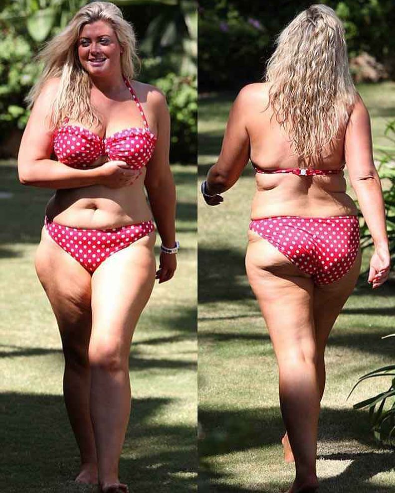 gemma collins in a bikini