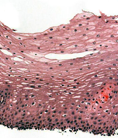 squamous epithelium meaning in hindi