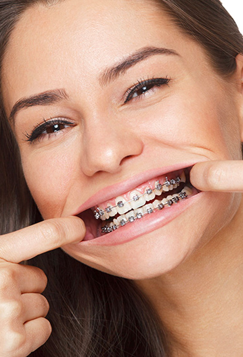 dental orthodontics for kids maple ridge
