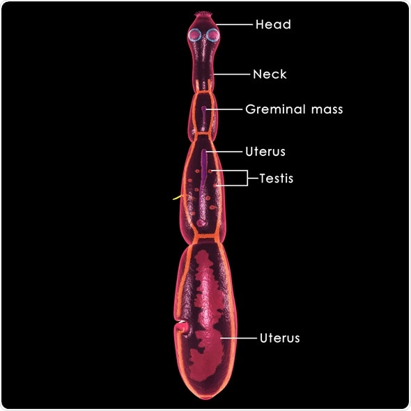 what is hydatid cyst