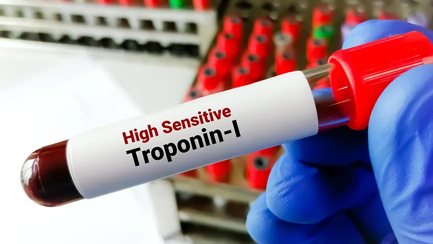 troponin c nedir