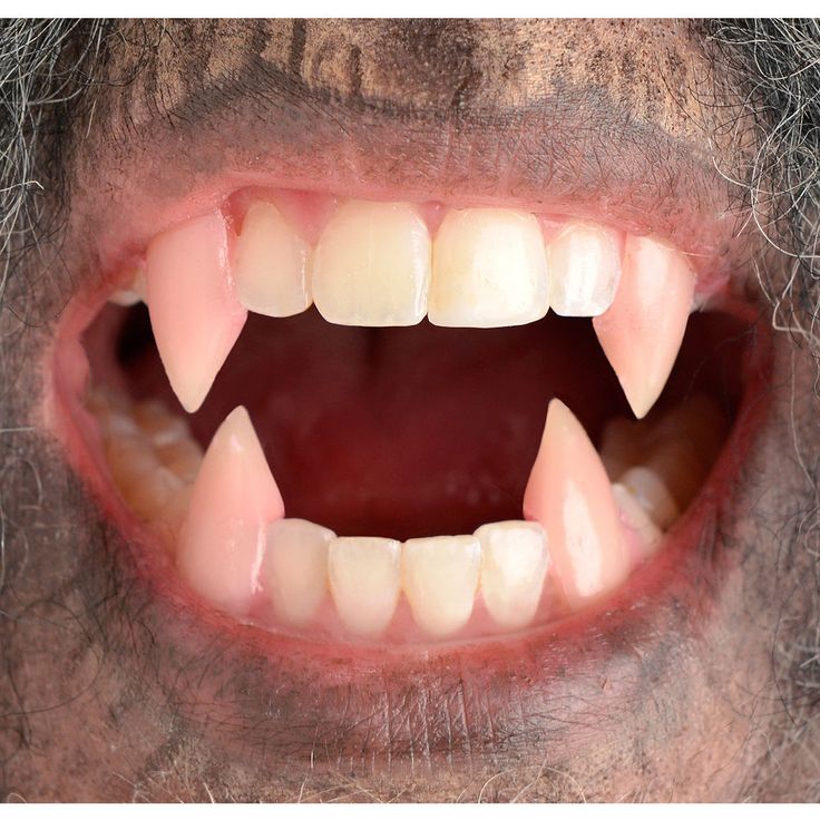 werewolf teeth