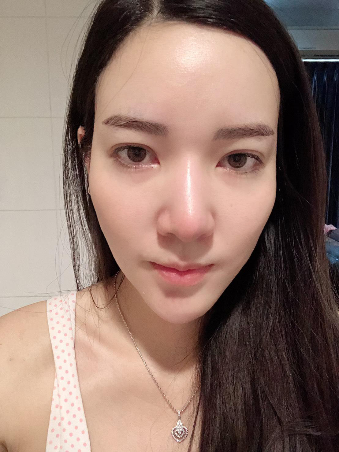 jewelry plastic surgery korea review