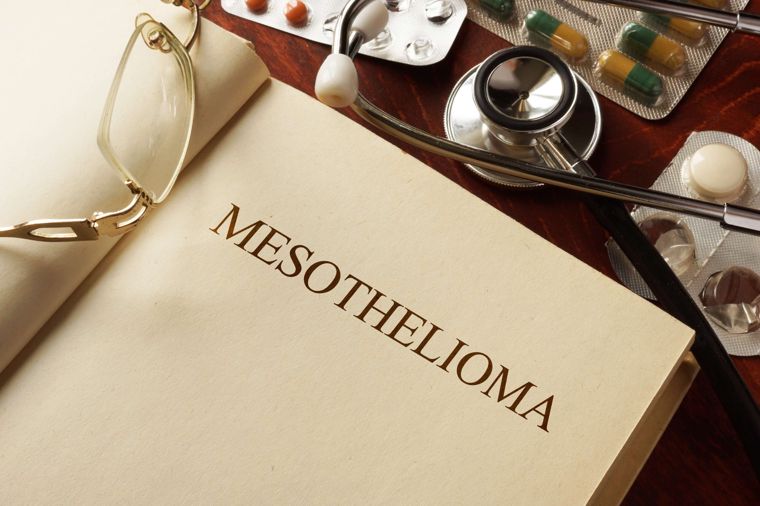 silver city mesothelioma legal question