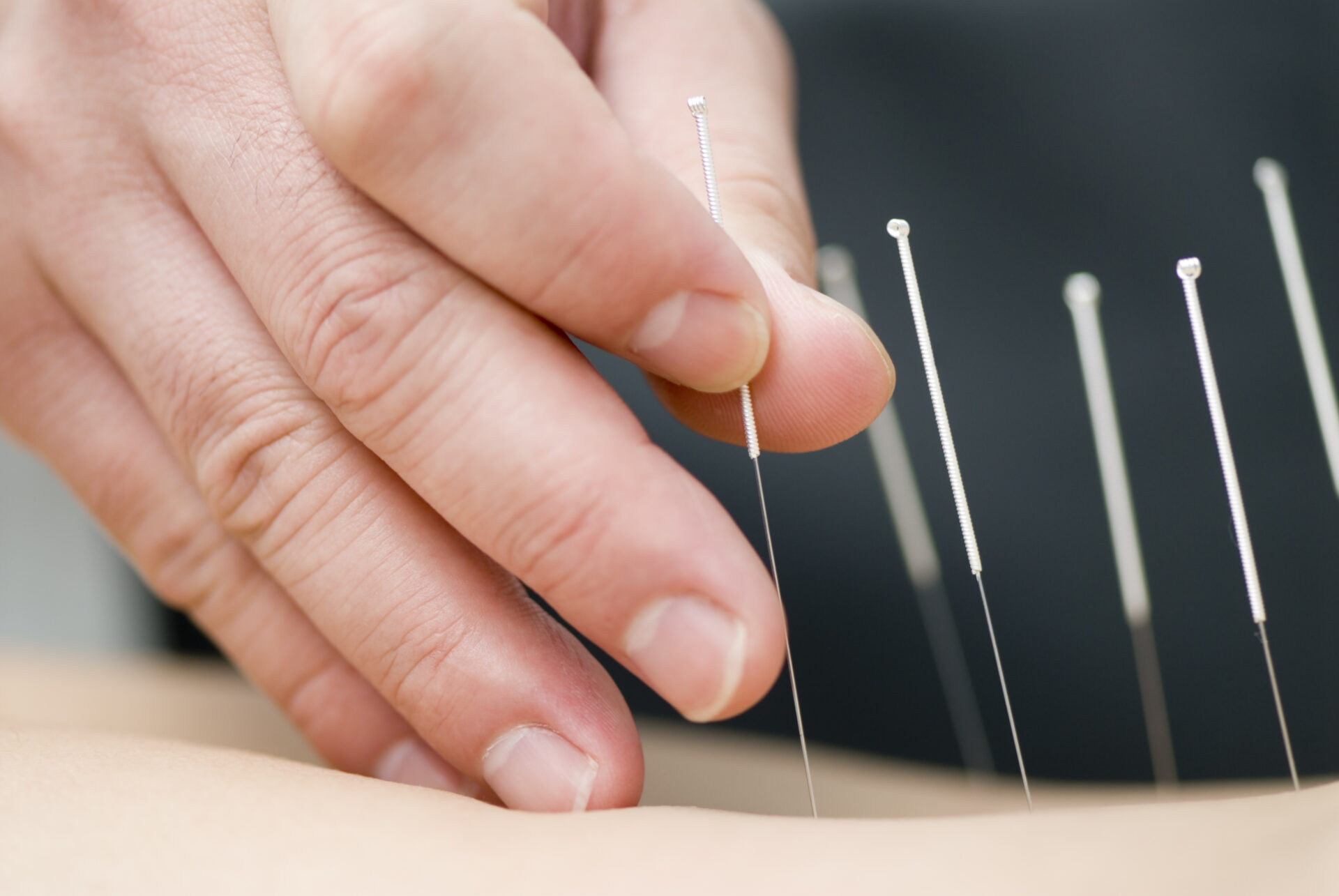 acupuncturist salary canada