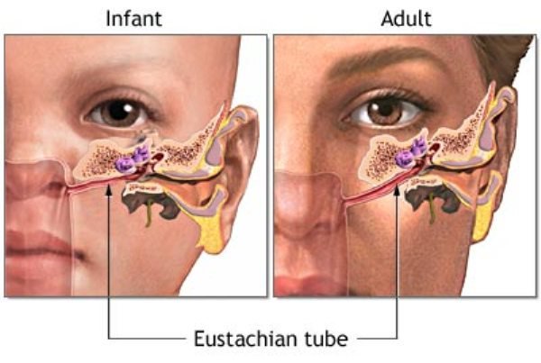 glue ear tips adults