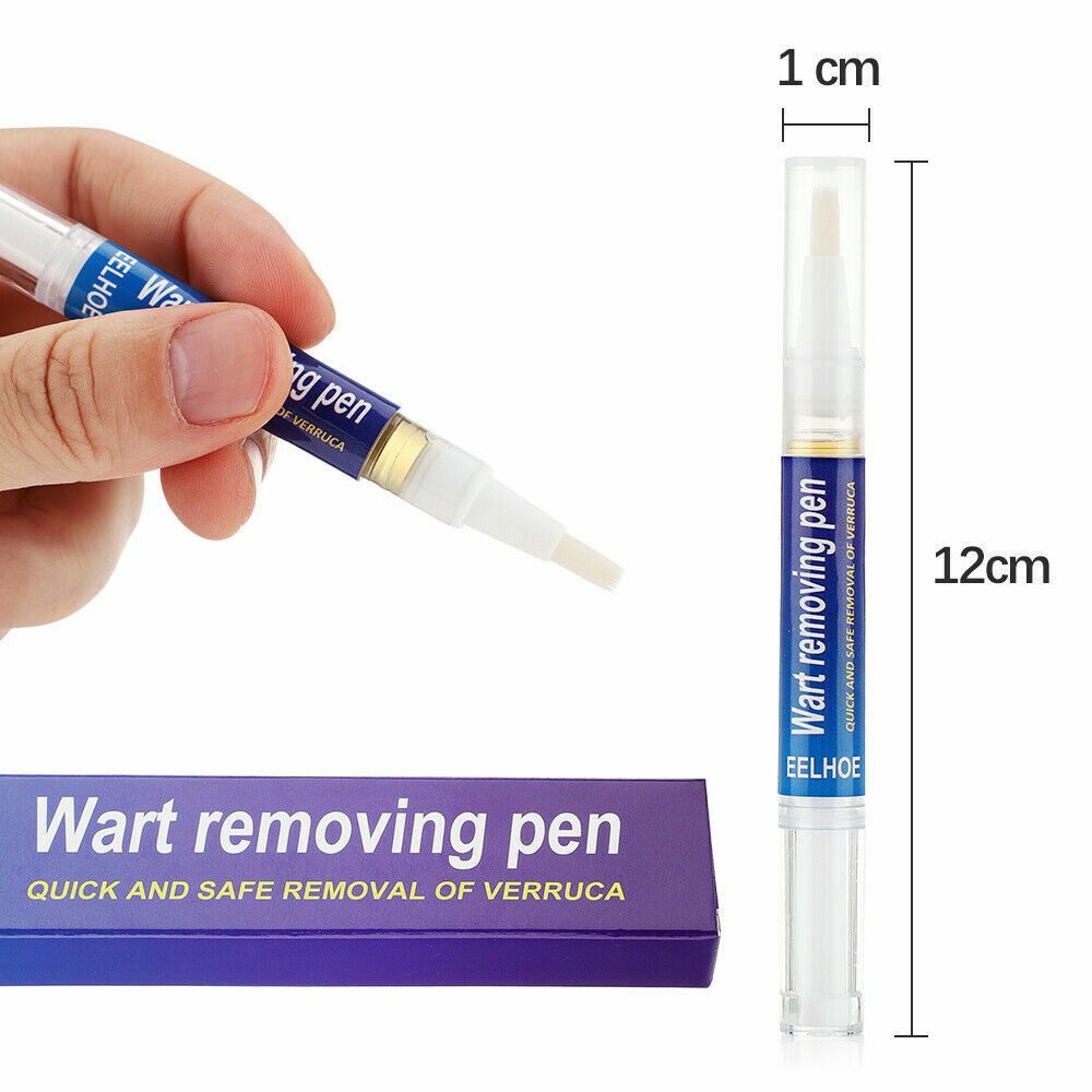 wart removal pen