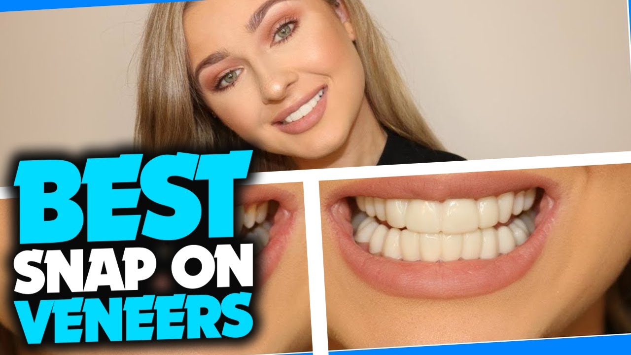 best clip on veneers