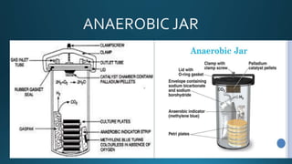 anaerobic jar diagram