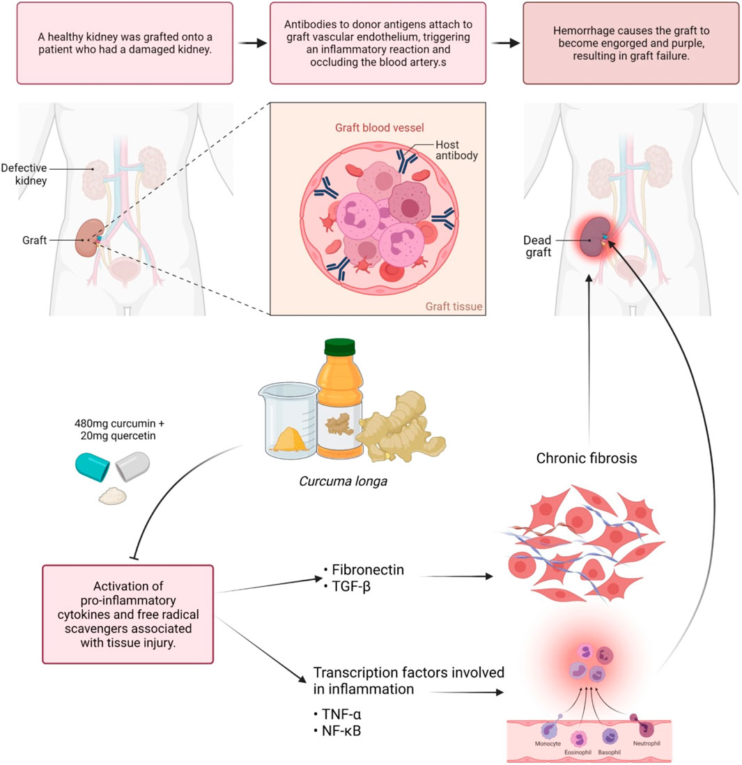 curcuma pubmed