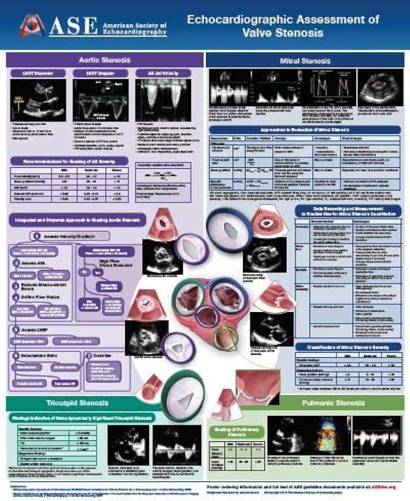 echocardiography poster