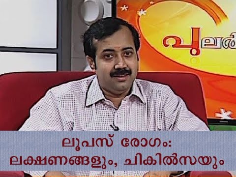 sle disease in malayalam