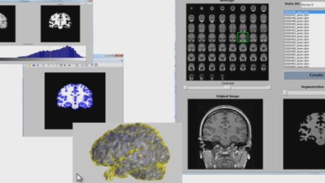 imaging matlab