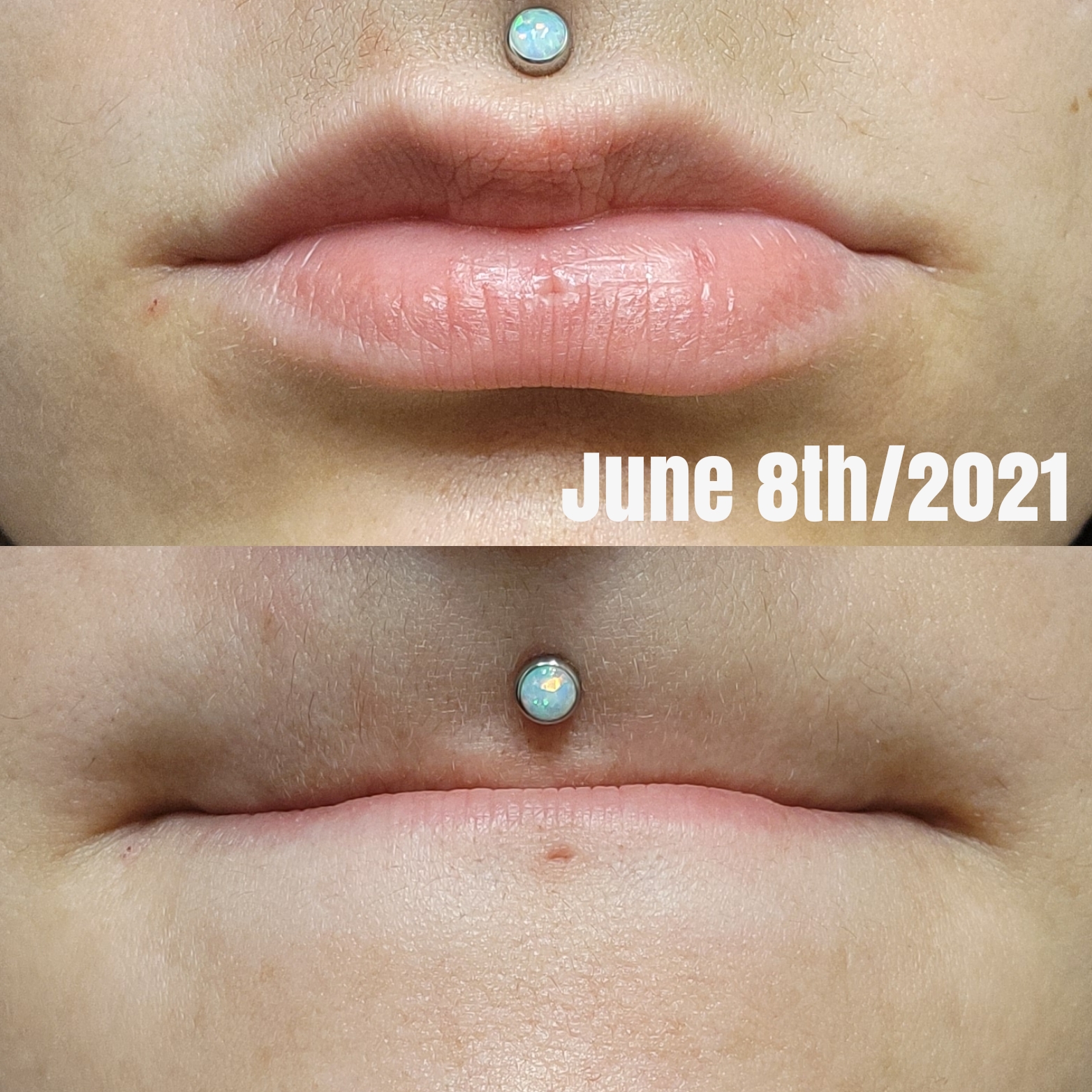 labret piercing vertical