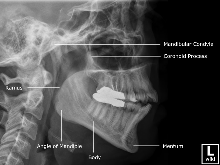 mandible anatomy radiology