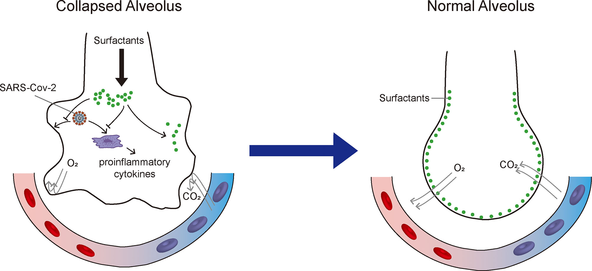 what is pulmonary surfactant